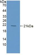 Western blot - Anti-Myoglobin antibody (AB231530), expandable thumbnail