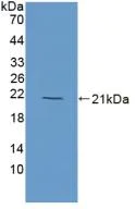 Western blot - Anti-Myoglobin antibody (AB231530)