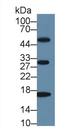 Western blot - Anti-Myoglobin antibody (AB231725)