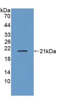 Western blot - Anti-Myoglobin antibody (AB231725)