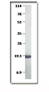Western blot - Anti-Myoglobin antibody (AB74995), expandable thumbnail