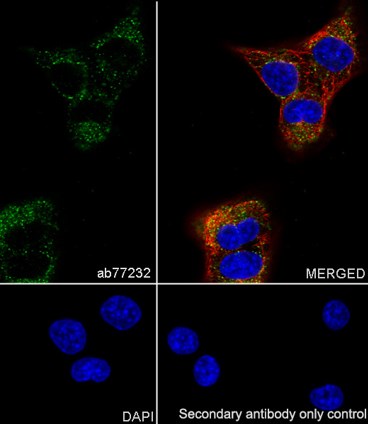 Immunocytochemistry/ Immunofluorescence - Anti-Myoglobin antibody [EP3081Y] (AB77232), expandable thumbnail