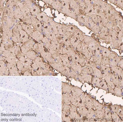Immunohistochemistry (Formalin/PFA-fixed paraffin-embedded sections) - Anti-Myoglobin antibody [EP3081Y] (AB77232), expandable thumbnail
