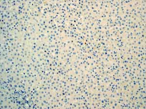 Immunohistochemistry (Formalin/PFA-fixed paraffin-embedded sections) - Anti-Myoglobin antibody [EP3081Y] (ab77232), expandable thumbnail