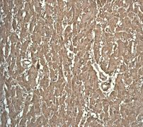 Immunohistochemistry (Formalin/PFA-fixed paraffin-embedded sections) - Anti-Myoglobin antibody [EP3081Y] (AB77232), expandable thumbnail