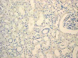 Immunohistochemistry (Formalin/PFA-fixed paraffin-embedded sections) - Anti-Myoglobin antibody [EP3081Y] (ab77232), expandable thumbnail