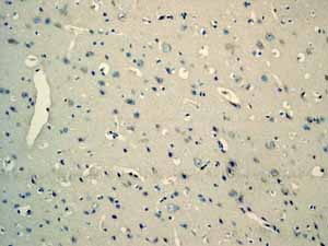 Immunohistochemistry (Formalin/PFA-fixed paraffin-embedded sections) - Anti-Myoglobin antibody [EP3081Y] (ab77232), expandable thumbnail