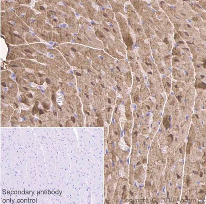 Immunohistochemistry (Formalin/PFA-fixed paraffin-embedded sections) - Anti-Myoglobin antibody [EP3081Y] (ab77232), expandable thumbnail