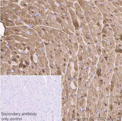 Immunohistochemistry (Formalin/PFA-fixed paraffin-embedded sections) - Anti-Myoglobin antibody [EP3081Y] (AB77232)