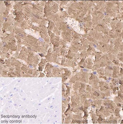 Immunohistochemistry (Formalin/PFA-fixed paraffin-embedded sections) - Anti-Myoglobin antibody [EP3081Y] (AB77232), expandable thumbnail