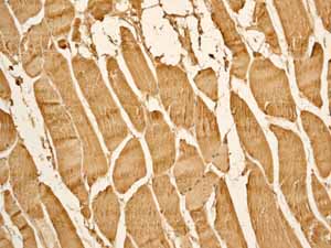 Immunohistochemistry (Formalin/PFA-fixed paraffin-embedded sections) - Anti-Myoglobin antibody [EP3081Y] (ab77232), expandable thumbnail