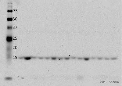 Western blot - Anti-Myoglobin antibody [EP3081Y] (ab77232), expandable thumbnail