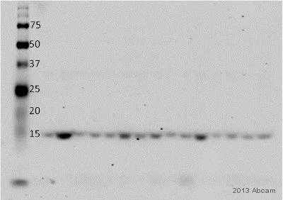 Western blot - Anti-Myoglobin antibody [EP3081Y] (AB77232)