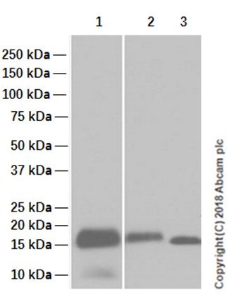 Western blot - Anti-Myoglobin antibody [EP3081Y] (AB77232), expandable thumbnail