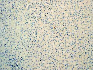 Immunohistochemistry (Formalin/PFA-fixed paraffin-embedded sections) - Anti-Myoglobin antibody [EP3081Y] - BSA and Azide free (AB232388)
