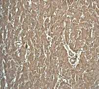 Immunohistochemistry (Formalin/PFA-fixed paraffin-embedded sections) - Anti-Myoglobin antibody [EP3081Y] - BSA and Azide free (AB232388)