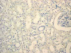 Immunohistochemistry (Formalin/PFA-fixed paraffin-embedded sections) - Anti-Myoglobin antibody [EP3081Y] - BSA and Azide free (AB232388)