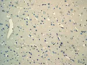 Immunohistochemistry (Formalin/PFA-fixed paraffin-embedded sections) - Anti-Myoglobin antibody [EP3081Y] - BSA and Azide free (AB232388)