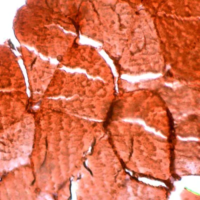 Immunohistochemistry (Formalin/PFA-fixed paraffin-embedded sections) - Anti-Myoglobin antibody, prediluted (AB228040)