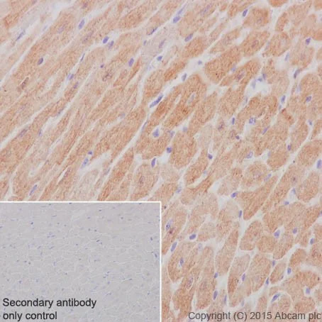 Immunohistochemistry (Formalin/PFA-fixed paraffin-embedded sections) - Anti-MYOM1 antibody [EPR17322-9] (AB205618)