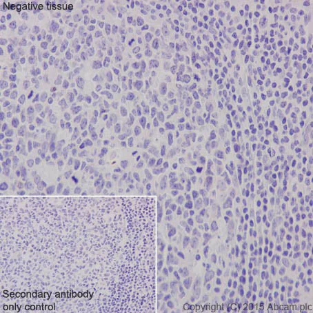 Immunohistochemistry (Formalin/PFA-fixed paraffin-embedded sections) - Anti-MYOM1 antibody [EPR17322-9] (AB205618)