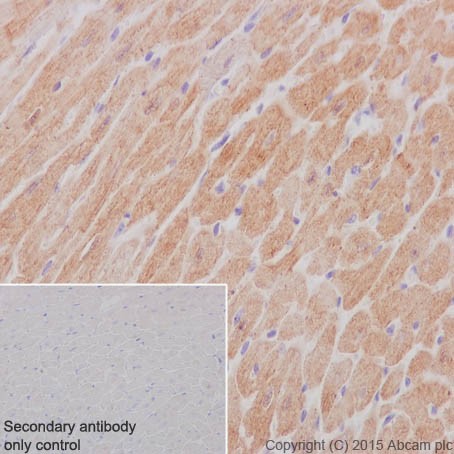 Immunohistochemistry (Formalin/PFA-fixed paraffin-embedded sections) - Anti-MYOM1 antibody [EPR17322-9] - BSA and Azide free (ab251439), expandable thumbnail