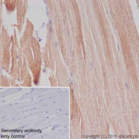 Immunohistochemistry (Formalin/PFA-fixed paraffin-embedded sections) - Anti-MYOM1 antibody [EPR17322-9] - BSA and Azide free (ab251439), expandable thumbnail