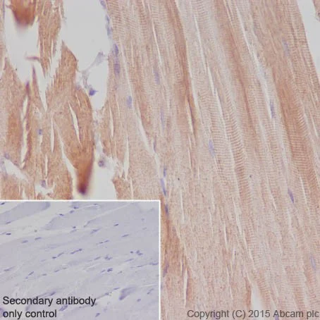 Immunohistochemistry (Formalin/PFA-fixed paraffin-embedded sections) - Anti-MYOM1 antibody [EPR17322-9] - BSA and Azide free (AB251439)