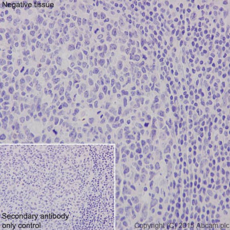 Immunohistochemistry (Formalin/PFA-fixed paraffin-embedded sections) - Anti-MYOM1 antibody [EPR17322-9] - BSA and Azide free (AB251439), expandable thumbnail