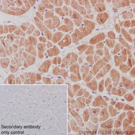 Immunohistochemistry (Formalin/PFA-fixed paraffin-embedded sections) - Anti-MYOM1 antibody [EPR17322-9] - BSA and Azide free (AB251439)