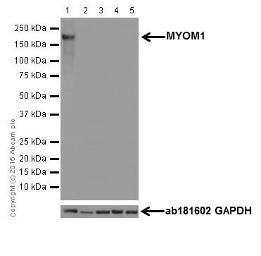 Western blot - Anti-MYOM1 antibody [EPR17322-9] - BSA and Azide free (AB251439), expandable thumbnail