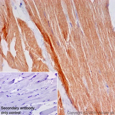 Immunohistochemistry (Formalin/PFA-fixed paraffin-embedded sections) - Anti-MYOM1 antibody [EPR17322] (ab201228), expandable thumbnail