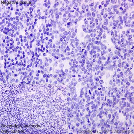 Immunohistochemistry (Formalin/PFA-fixed paraffin-embedded sections) - Anti-MYOM1 antibody [EPR17322] (AB201228)