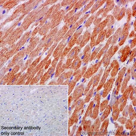 Immunohistochemistry (Formalin/PFA-fixed paraffin-embedded sections) - Anti-MYOM1 antibody [EPR17322] - BSA and Azide free (ab251338), expandable thumbnail