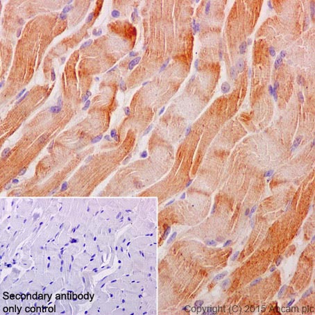 Immunohistochemistry (Formalin/PFA-fixed paraffin-embedded sections) - Anti-MYOM1 antibody [EPR17322] - BSA and Azide free (AB251338), expandable thumbnail