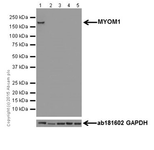 Western blot - Anti-MYOM1 antibody [EPR17322] - BSA and Azide free (AB251338), expandable thumbnail