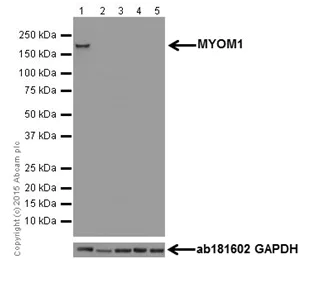 Western blot - Anti-MYOM1 antibody [EPR17322] - BSA and Azide free (AB251338)