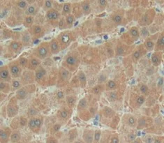 Immunohistochemistry (Formalin/PFA-fixed paraffin-embedded sections) - Anti-MYOM2 antibody (AB233263)