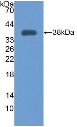 Western blot - Anti-MYOM2 antibody (AB233263)