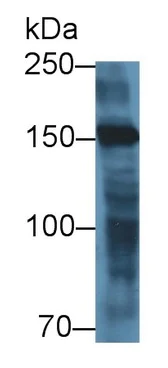 Western blot - Anti-MYOM2 antibody (AB233263)