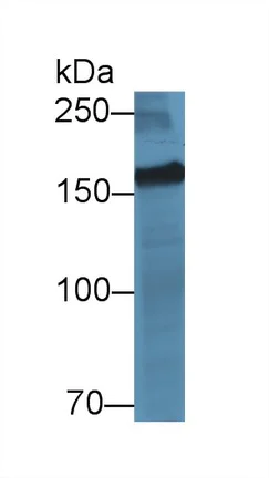 Western blot - Anti-MYOM2 antibody (AB233263)