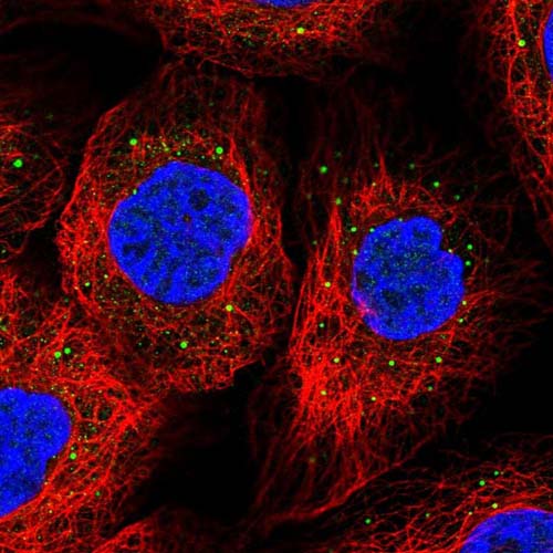Immunocytochemistry/ Immunofluorescence - Anti-MYOM3 antibody (AB121973)