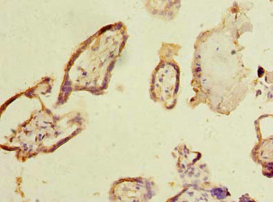 Immunohistochemistry (Formalin/PFA-fixed paraffin-embedded sections) - Anti-Myoneurin antibody (AB238912), expandable thumbnail