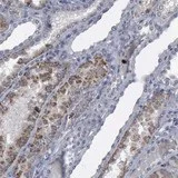 Immunohistochemistry (Formalin/PFA-fixed paraffin-embedded sections) - Anti-Myosin 18B antibody (AB121125)