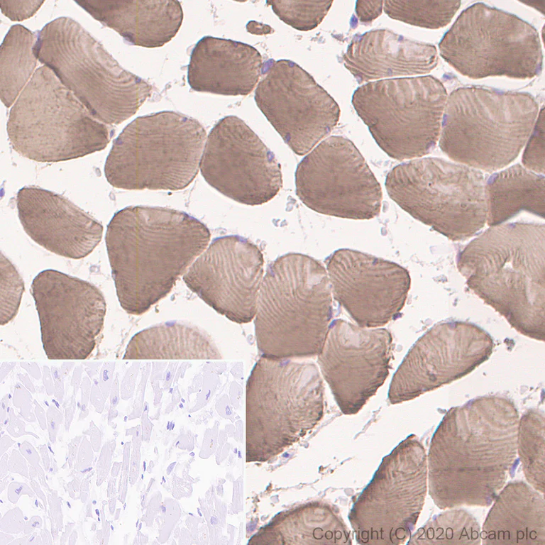 Immunohistochemistry (Formalin/PFA-fixed paraffin-embedded sections) - Anti-Myosin heavy chain antibody [A4.1025] - BSA and Azide free (AB264490)
