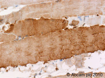 Immunohistochemistry (Formalin/PFA-fixed paraffin-embedded sections) - Anti-Myosin Light Chain 2 antibody (AB48003)