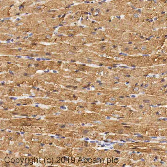 Immunohistochemistry (Formalin/PFA-fixed paraffin-embedded sections) - Anti-Myosin Light Chain 2 antibody (AB79935)