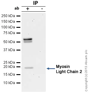 Immunoprecipitation - Anti-Myosin Light Chain 2 antibody (AB79935)