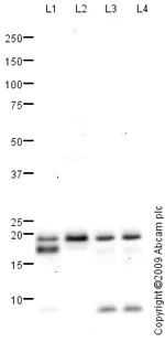 Western blot - Anti-Myosin Light Chain 2 antibody (AB79935)