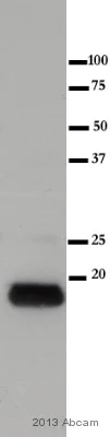 Western blot - Anti-Myosin Light Chain 2 antibody [AT3B2] (AB89594)